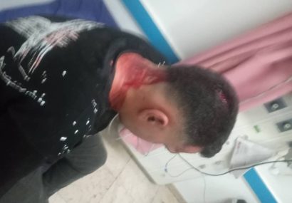 حمله دستفروشان به مأموران اجرائیات شهرداری مسجدسلیمان / جراحت شدید یکی از کارکنان در حین انجام مأموریت