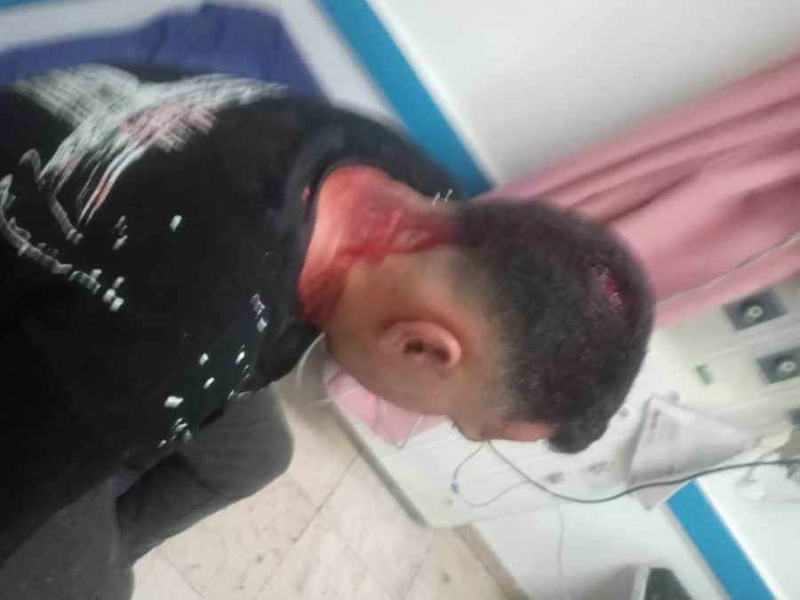 حمله دستفروشان به مأموران اجرائیات شهرداری مسجدسلیمان / جراحت شدید یکی از کارکنان در حین انجام مأموریت